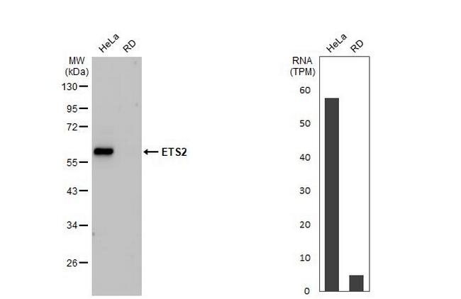 ETS2 Antibody in Western Blot (WB)