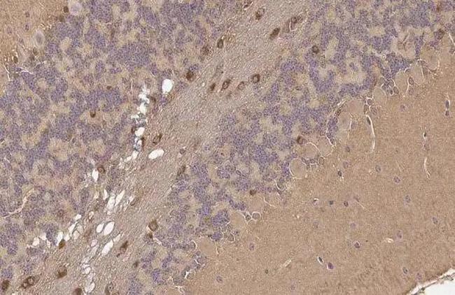 PSAT1 Antibody in Immunohistochemistry (Paraffin) (IHC (P))