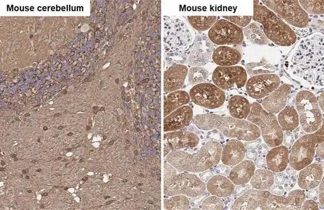 Glutamine Synthetase Antibody in Immunohistochemistry (Paraffin) (IHC (P))