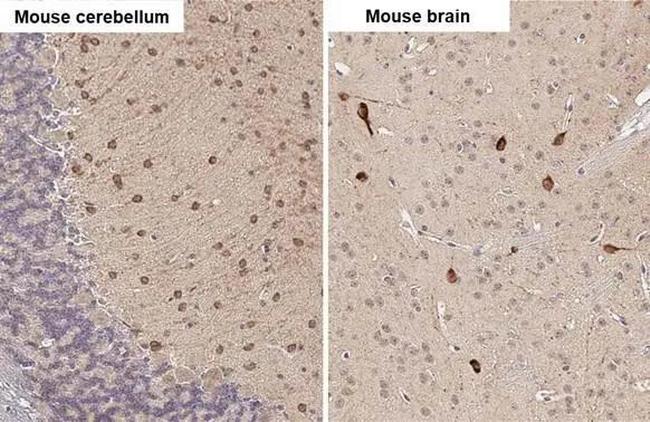 RNF31 Antibody in Immunohistochemistry (Paraffin) (IHC (P))