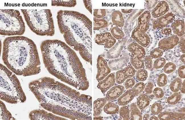 ST6GAL1 Antibody in Immunohistochemistry (Paraffin) (IHC (P))