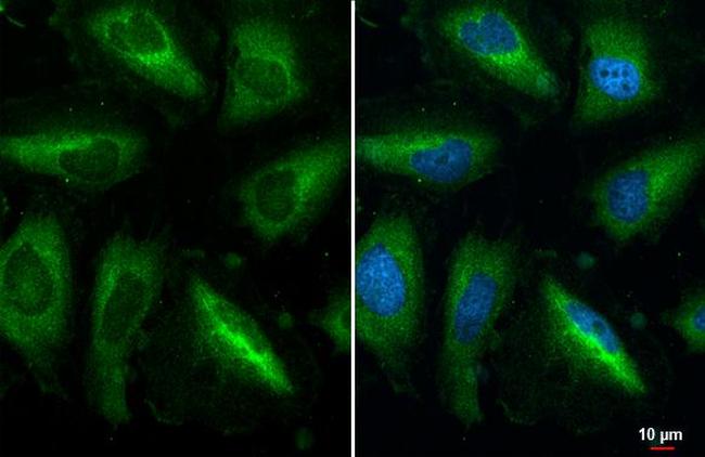 RPL32 Antibody in Immunocytochemistry (ICC/IF)