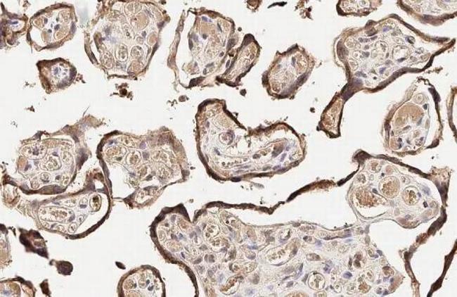 Aromatase Antibody in Immunohistochemistry (Paraffin) (IHC (P))