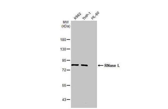 RNaseL Antibody in Western Blot (WB)