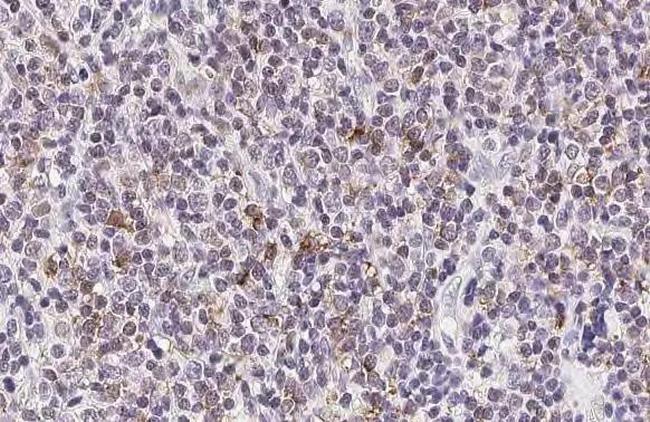 TNF alpha Antibody in Immunohistochemistry (Paraffin) (IHC (P))