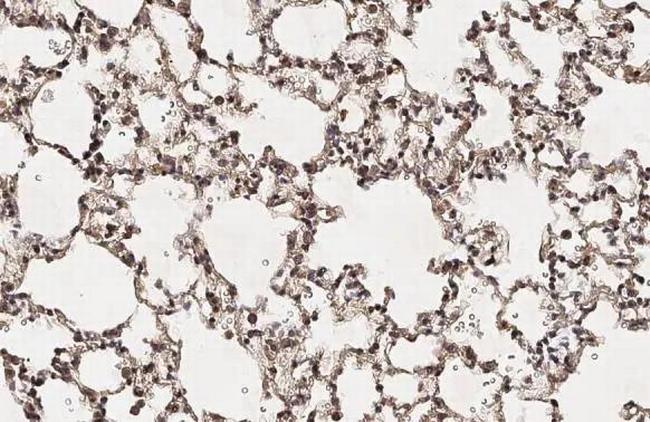 HEY1 Antibody in Immunohistochemistry (Paraffin) (IHC (P))