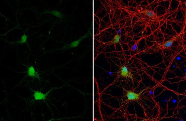 Calbindin D28K Antibody in Immunocytochemistry (ICC/IF)