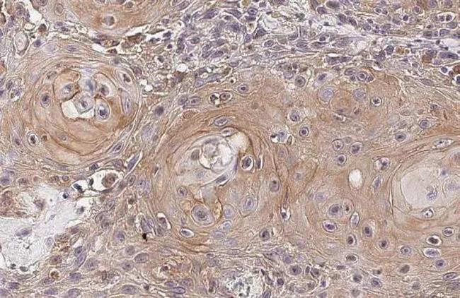 IL-6 Antibody in Immunohistochemistry (Paraffin) (IHC (P))