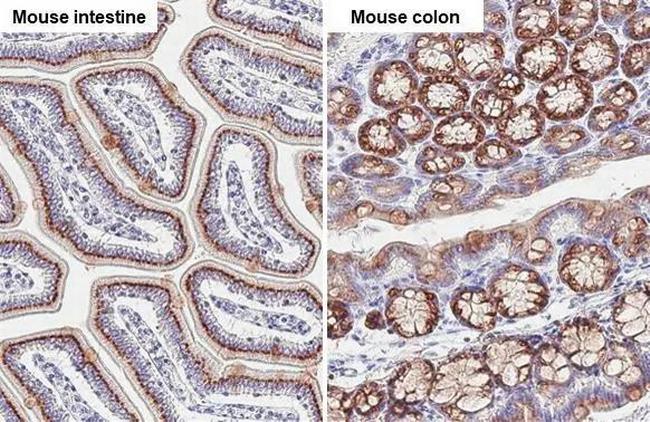 GALNT6 Antibody in Immunohistochemistry (Paraffin) (IHC (P))