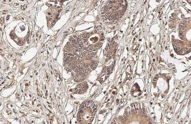 OASL Antibody in Immunohistochemistry (Paraffin) (IHC (P))