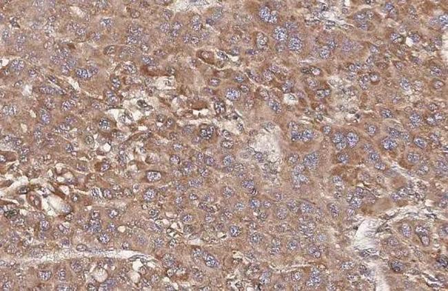 Transferrin Antibody in Immunohistochemistry (Paraffin) (IHC (P))