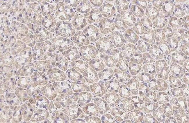 BCKDHA Antibody in Immunohistochemistry (Paraffin) (IHC (P))