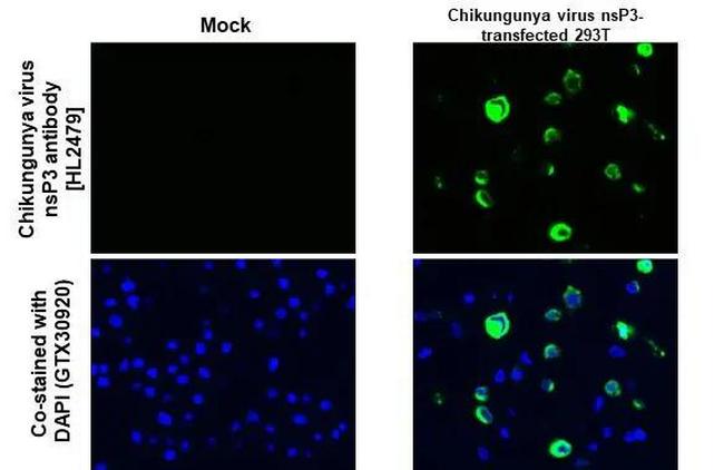 Chikungunya Virus NSP3 Antibody in Immunocytochemistry (ICC/IF)