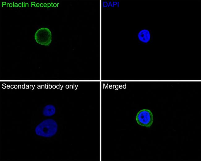 Prolactin Receptor Antibody in Immunocytochemistry (ICC/IF)