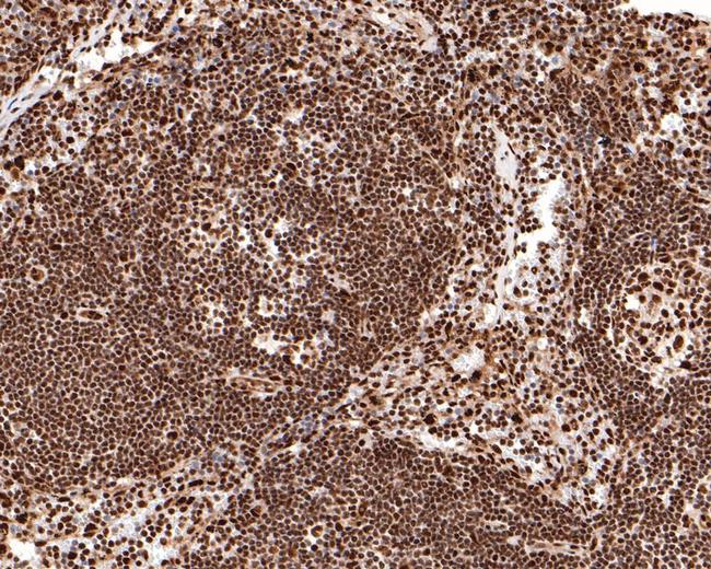 BRCA1 Antibody in Immunohistochemistry (Paraffin) (IHC (P))