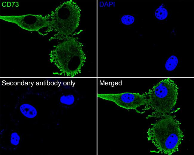 CD73 Antibody in Immunocytochemistry (ICC/IF)