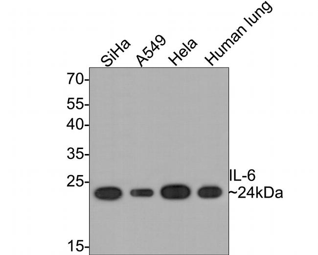 IL-6 Antibody in Western Blot (WB)