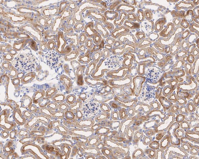 K-Ras Antibody in Immunohistochemistry (Paraffin) (IHC (P))