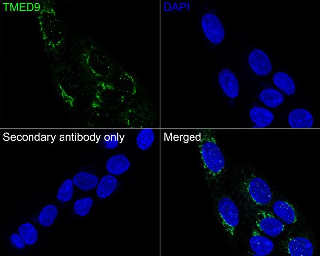 TMED9 Antibody in Immunocytochemistry (ICC/IF)