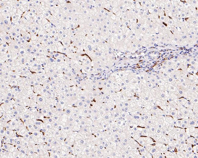 CD204 Antibody in Immunohistochemistry (Paraffin) (IHC (P))