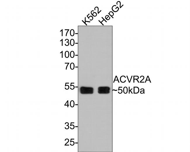 ACVR2A Antibody in Western Blot (WB)