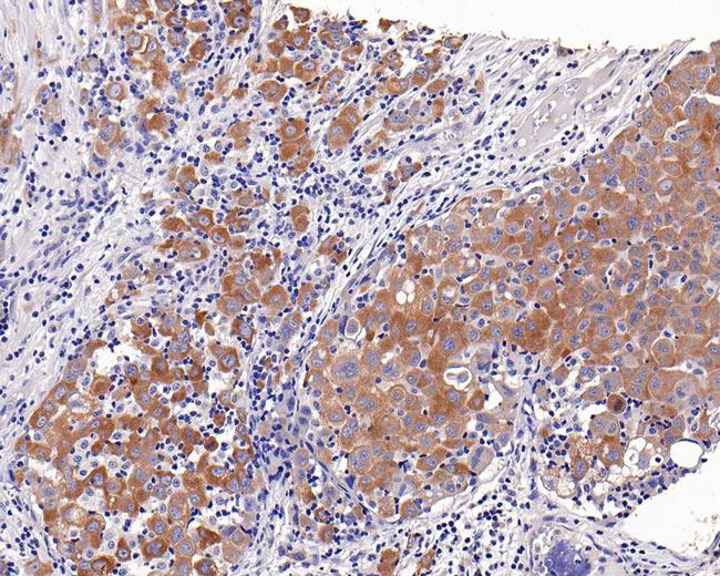 c-Met Antibody in Immunohistochemistry (Paraffin) (IHC (P))