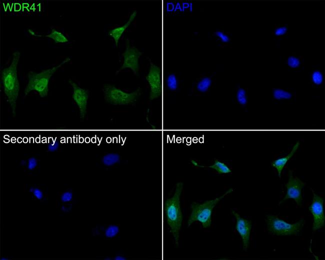 WDR41 Antibody in Immunocytochemistry (ICC/IF)