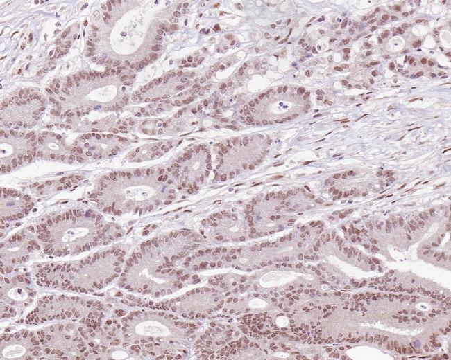 MLH1 Antibody in Immunohistochemistry (Paraffin) (IHC (P))