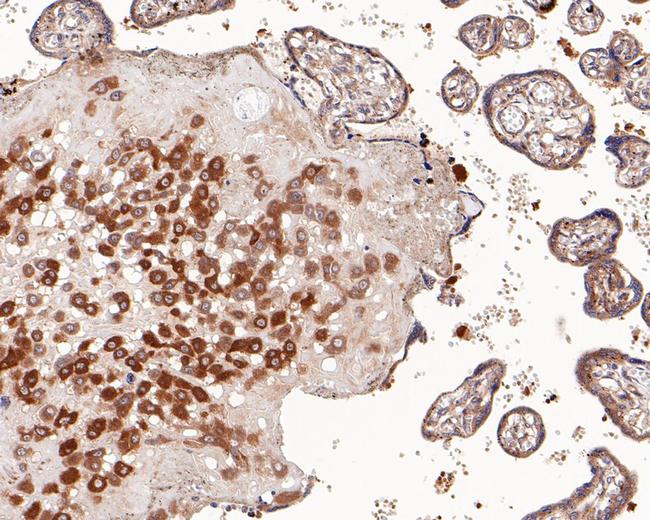 ROBO1 Antibody in Immunohistochemistry (Paraffin) (IHC (P))