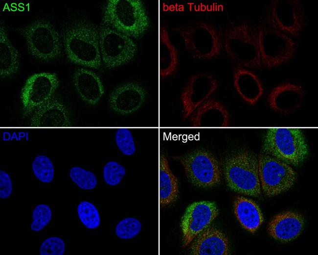 ASS1 Antibody in Immunocytochemistry (ICC/IF)