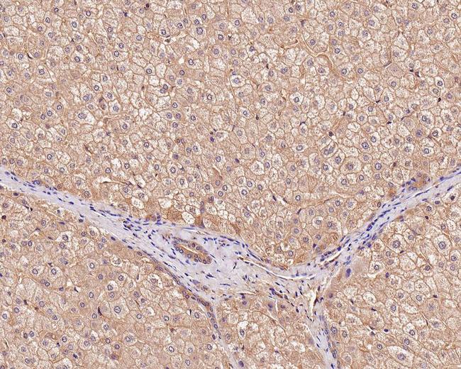 Bax Antibody in Immunohistochemistry (Paraffin) (IHC (P))