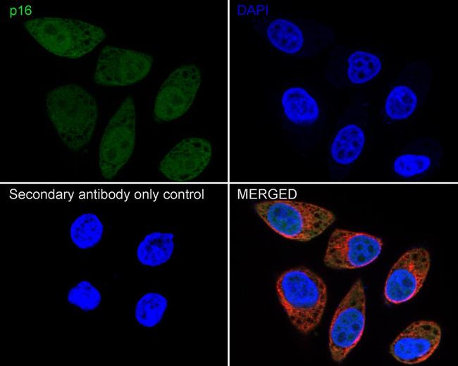 p16INK4a Antibody in Immunocytochemistry (ICC/IF)