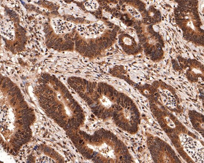 PIN4 Antibody in Immunohistochemistry (Paraffin) (IHC (P))