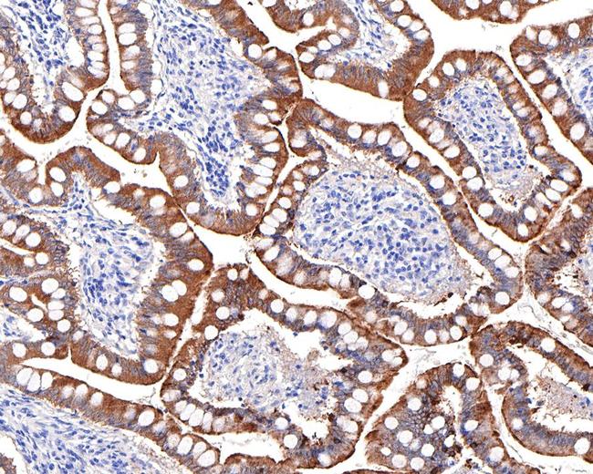 Villin Antibody in Immunohistochemistry (Paraffin) (IHC (P))