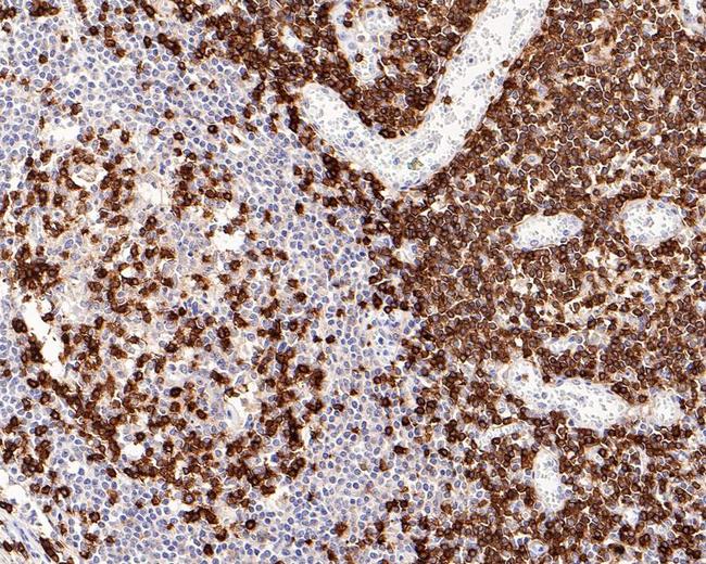 CD5 Antibody in Immunohistochemistry (Paraffin) (IHC (P))