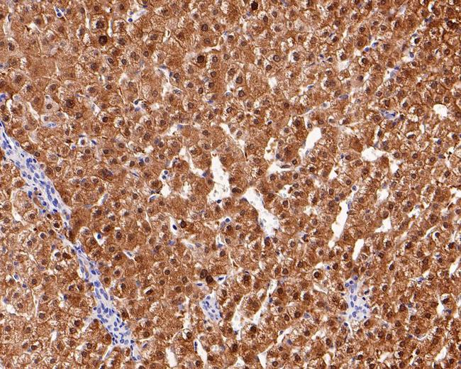 Arginase 1 Antibody in Immunohistochemistry (Paraffin) (IHC (P))