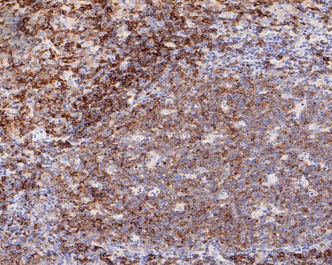 CD22 Antibody in Immunohistochemistry (Paraffin) (IHC (P))