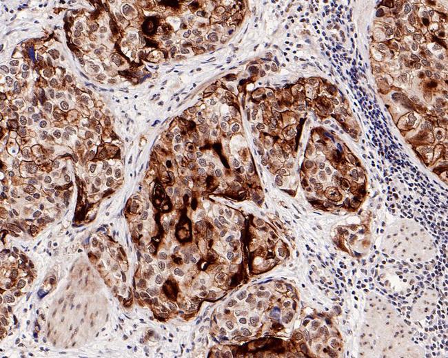 UPK3A Antibody in Immunohistochemistry (Paraffin) (IHC (P))