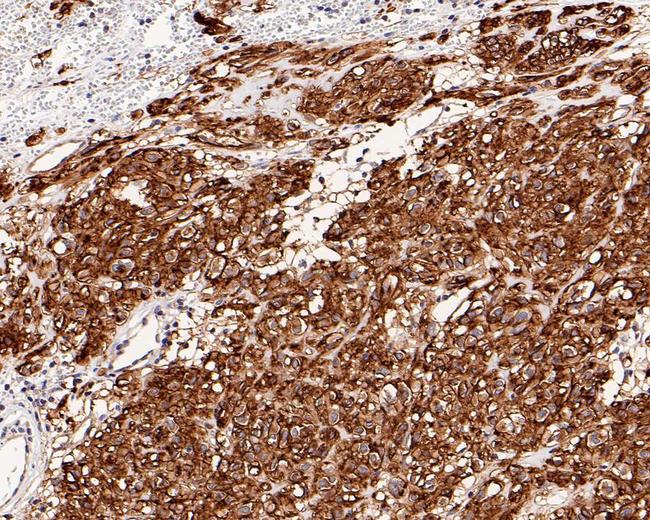 DOG-1 Antibody in Immunohistochemistry (Paraffin) (IHC (P))