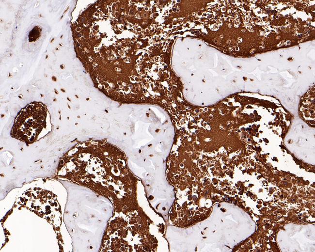 Hemoglobin alpha Antibody in Immunohistochemistry (Paraffin) (IHC (P))