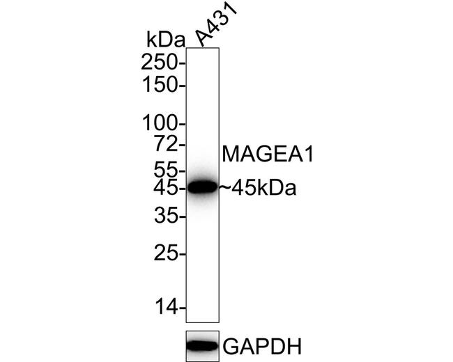 MAGE1 Antibody in Immunohistochemistry (Paraffin) (IHC (P))