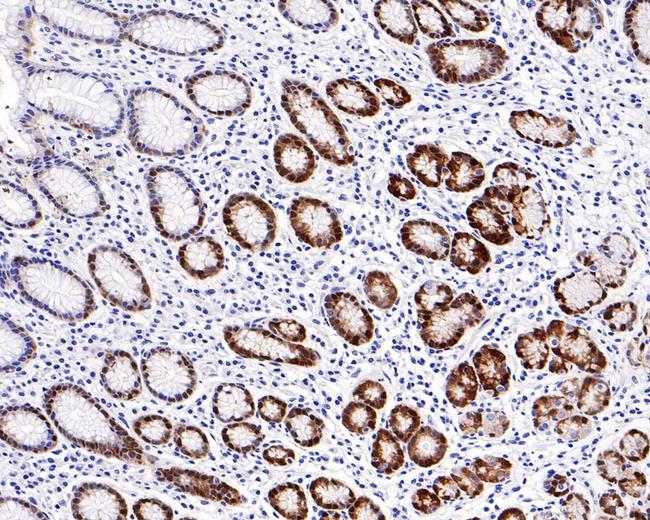 ALDH3A1 Antibody in Immunohistochemistry (Paraffin) (IHC (P))