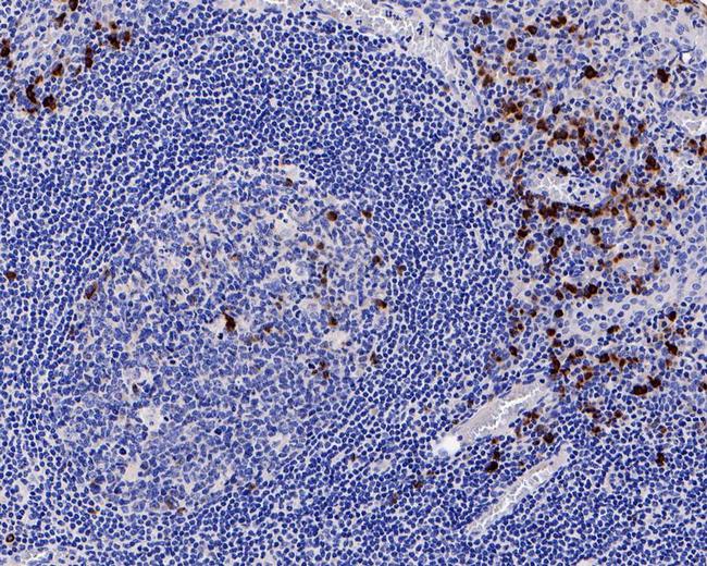 J Chain Antibody in Immunohistochemistry (Paraffin) (IHC (P))