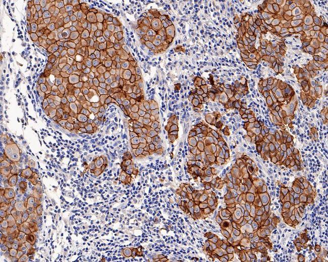 ErbB2 (HER-2) Antibody in Immunohistochemistry (Paraffin) (IHC (P))