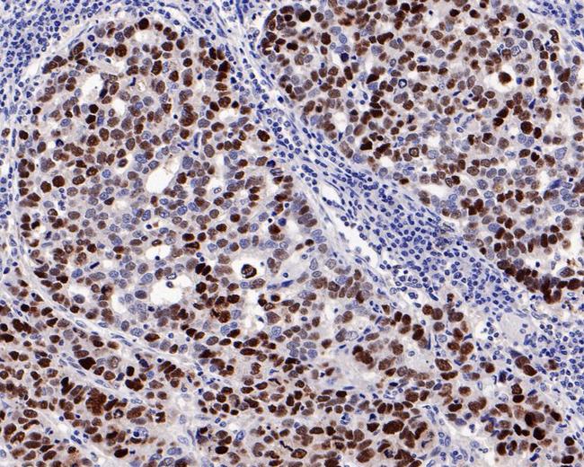 p53 Antibody in Immunohistochemistry (Paraffin) (IHC (P))