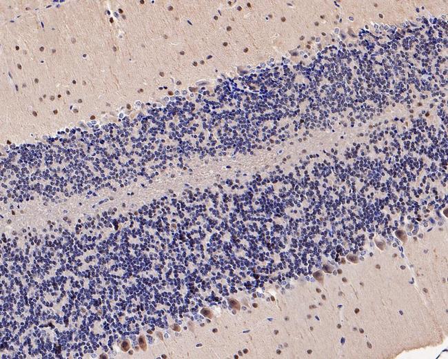 UBE1L Antibody in Immunohistochemistry (Paraffin) (IHC (P))