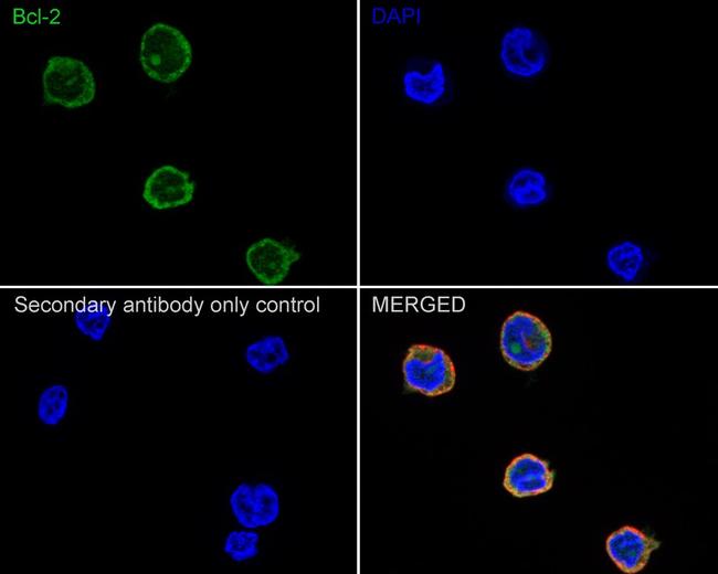 Bcl-2 Antibody in Immunocytochemistry (ICC/IF)