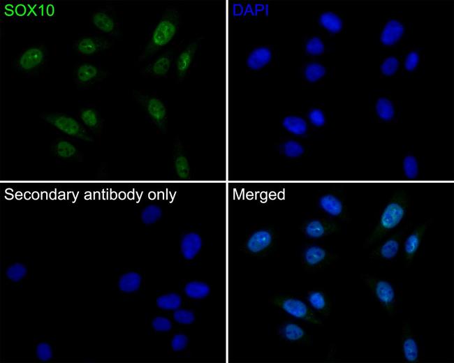 SOX10 Antibody in Immunocytochemistry (ICC/IF)