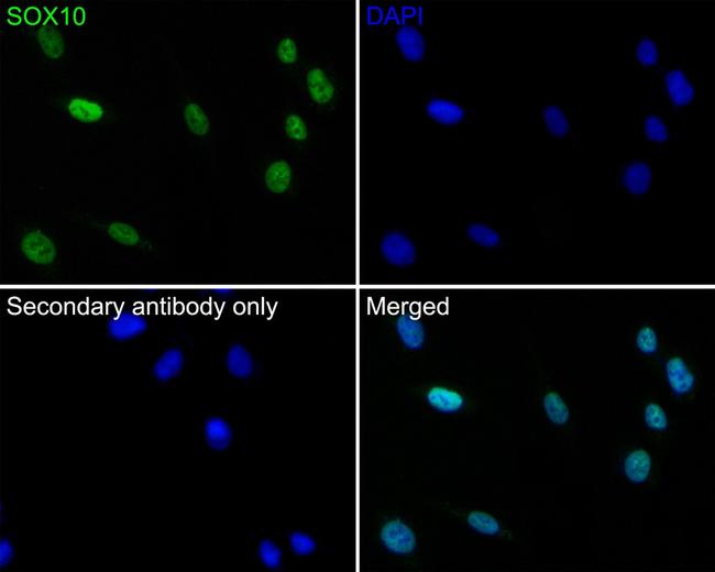 SOX10 Antibody in Immunocytochemistry (ICC/IF)