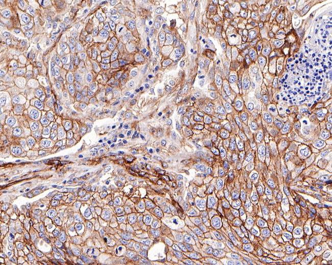 B7-H3 Antibody in Immunohistochemistry (Paraffin) (IHC (P))